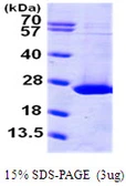 Human ARL1 protein, His tag. GTX67236-pro