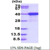 Human Aspartoacylase protein, His tag. GTX67241-pro