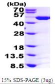 Human ASS1 protein, His tag. GTX67243-pro