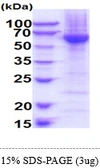 Human BLK protein, His tag. GTX67253-pro