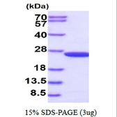 Human Flavin reductase protein. GTX67254-pro