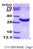 Human BPGM protein, His tag. GTX67255-pro
