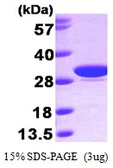 Human Carbonic Anhydrase 1 protein, His tag. GTX67257-pro