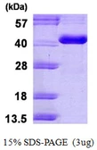 Human CA8 protein, His tag. GTX67259-pro