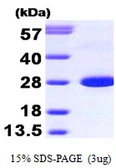 Human Calbindin protein. GTX67260-pro