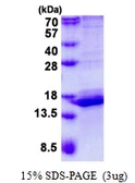 Human CALML3 protein, His tag. GTX67263-pro