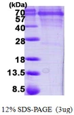 Human CaMKIV protein, His tag. GTX67264-pro