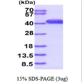 Human CAPG protein. GTX67265-pro