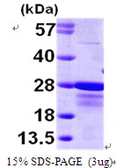 Human CBFb protein, His tag. GTX67268-pro