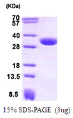 Human CBR1 protein. GTX67269-pro