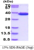 Human CBR3 protein, His tag. GTX67270-pro