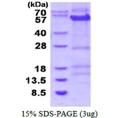Human Cyclin B1 protein, His tag. GTX67273-pro