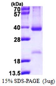 Human Cyclin D2 protein, His tag. GTX67274-pro