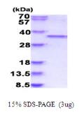 Human CDC2 protein, His tag. GTX67277-pro