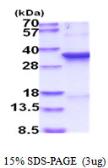 Human CDC2 protein, His tag. GTX67278-pro