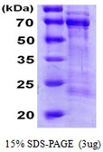 Human CDC25A protein, His tag. GTX67279-pro