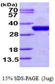 Human CDC34 protein, His tag. GTX67280-pro