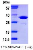 Human CDK2 protein, His tag. GTX67281-pro