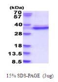 Human CDK2 protein, His tag. GTX67282-pro