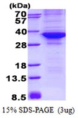Human CDK4 protein, His tag. GTX67284-pro