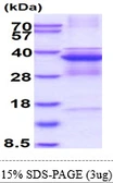Human CDK5 protein, His tag. GTX67285-pro