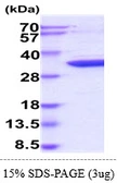 Human CDK5 protein, His tag. GTX67286-pro