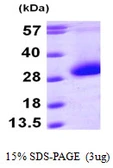 Human CDKN3 protein, His tag. GTX67290-pro