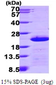 Human Centrin 2 protein, His tag. GTX67292-pro