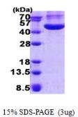 Human CHI3L1 protein, His tag. GTX67296-pro