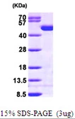 Human Creatine kinase (brain) protein, His tag. GTX67297-pro