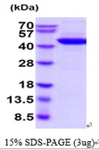 Human Creatine kinase (brain) protein. GTX67298-pro