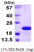 Human CIRBP protein, His tag. GTX67299-pro