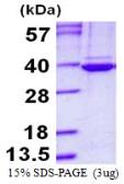 Human CKAP1 protein, His tag. GTX67300-pro