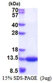 Human CKS1 protein, His tag. GTX67301-pro