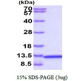 Human CKS2 protein, T7 tag. GTX67302-pro