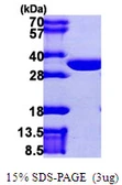 Human CLIC2 protein, His tag. GTX67306-pro