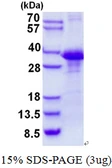 Human CLNS1A protein, His tag. GTX67307-pro