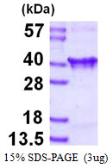 Human CLTA protein, His tag. GTX67308-pro