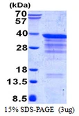Human CLTB protein, His tag. GTX67309-pro
