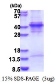 Human KLF6 protein, His tag. GTX67313-pro