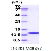 Human CRABP2 protein. GTX67315-pro