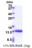Human CRIP1 protein, His tag. GTX67316-pro