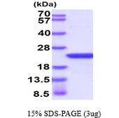 Human alpha B Crystallin protein. GTX67321-pro
