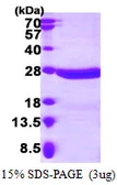 Human beta A4 Crystallin protein, His tag. GTX67322-pro