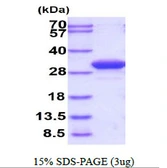 Human beta B1 Crystallin protein, His tag. GTX67323-pro