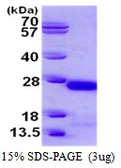 Human gamma C Crystallin protein, His tag. GTX67324-pro