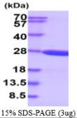 Human Beta crystallin S protein, His tag. GTX67326-pro