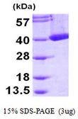 Human CRYM protein, His tag. GTX67327-pro