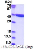 Human CRYZ protein, His tag. GTX67328-pro