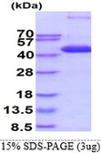 Human p38 MAPK protein, His tag. GTX67329-pro